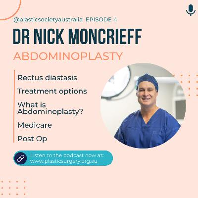 Ep4 A win for women suffering with rectus diastasis