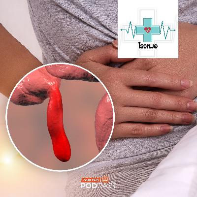 โรงหมอ EP. 1153: ไส้ติ่งอักเสบ ปวดอย่าปล่อยอันตรายเสี่ยงแตก โรงหมอ EP. 1153: ไส้ติ่งอักเสบ ปวดอย่าปล่อยอันตรายเสี่ยงแตก