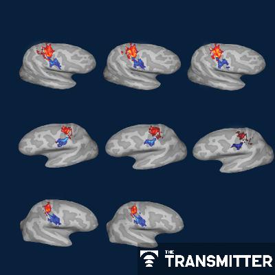 Adult human cortex does not 'reorganize' after amputation