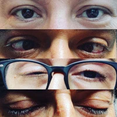 ERO - Capítulo 185 - Despedida de temporada en diferentes formas y sensaciones. ERO - Capítulo 185 - Despedida de temporada en diferentes formas y sensaciones.