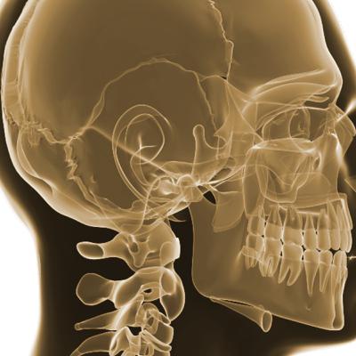 Disfunción temporomandibular