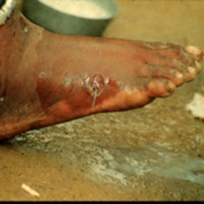 Are Worms Worthy of Conserving? by Jack Werner