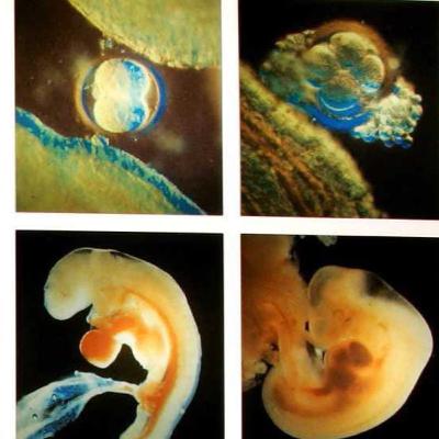 The Nefarious Goal Behind Covid Testing