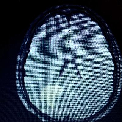 Nathan McCrary: A Ranger at War with MS Nathan McCrary: A Ranger at War with MS