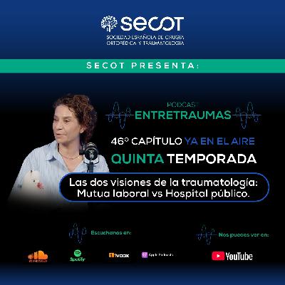 Las dos visiones de la traumatología: Mutua laboral vs Hospital público