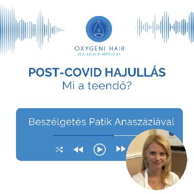 Mi a teendő, ha COVID után hajhullást tapasztalunk?