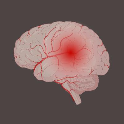 Fire in the Brain: Alzheimer's Hidden Driver - Neuroinflammation