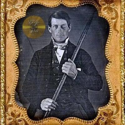 Hierro ATRAVIESA su Cabeza, ESCUPE su propio Cerebro, le crecen HONGOS en el Cráneo y SOBREVIVE