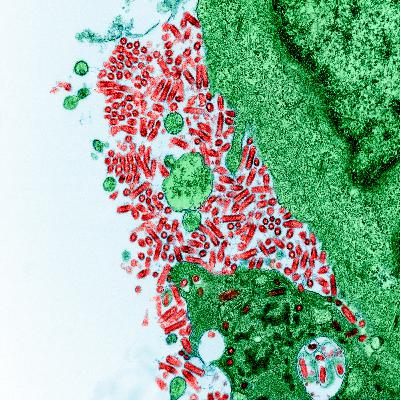 Ep. 36: Rabies: Molecular Masterpiece and Immune Saboteur—The Five-Gene Virus, Global Tracking, and the Fight to Cure the Uncurable