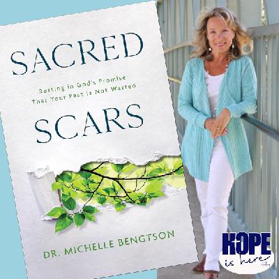 Sacred Scars