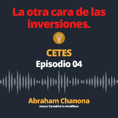 Episodio 04: Cetes Episodio 04: Cetes
