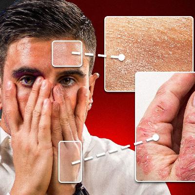 Los Alimentos que Ningún Dermatólogo Tomaría (Arrugan tu Piel)