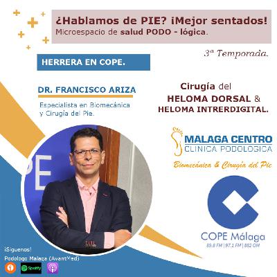 Cirugía heloma dorsal & interdigital ¿Hablmos de PIE? ¡Mejor sentados! 14x03 |Microespacio de salud podoLÓGICA 27/11/202