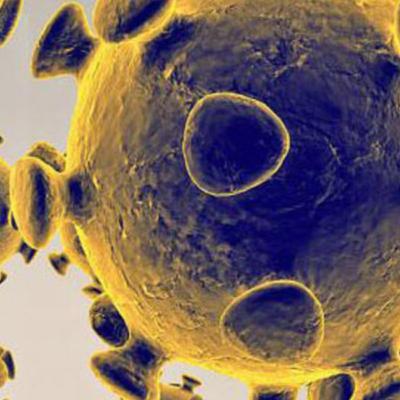 LISTEN: CORONAVIRUS UPDATE (Sun. April 19) - Okaloosa reports another death, Bay with 10 more cases, statewide death toll at 764