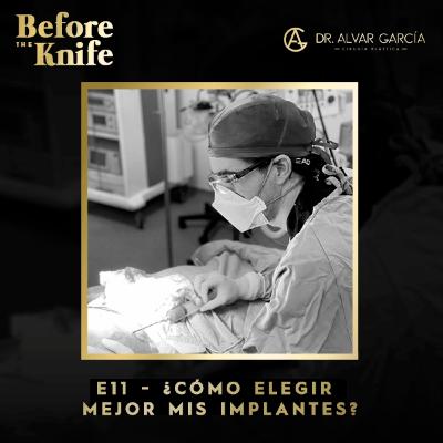 011 - ¿Cómo elegir mejor mis implantes?
