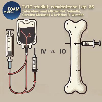 IVIO studiet – resultaterne | ep. 86