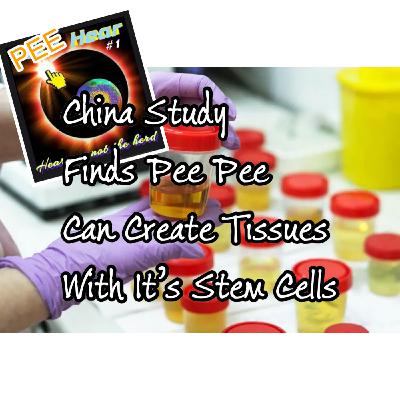 Episode 143: Art-icle China Study on Urine Derived Stem Cells and their effectiveness in regeneration of tissues. Episode 143: Art-icle China Study on Urine Derived Stem Cells and their effectiveness in regeneration of tissues.