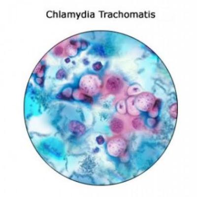 Chlamydia trachomatis