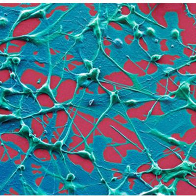 People with some cancers live longer after a COVID vaccine