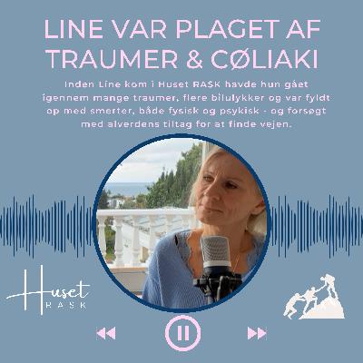 07. Line var fyldt op med traumer, cøliaki og smerter