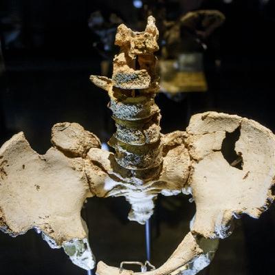 El caso Elvis: las caderas más famosas de la prehistoria.