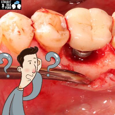Marginal bone loss in functional implants