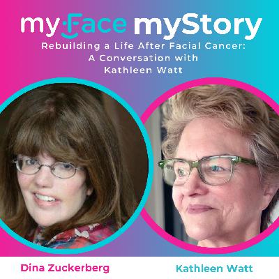 Rebuilding a Life After Facial Cancer: A Conversation with Kathleen Watt