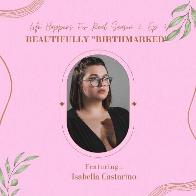 Beautifully Birthmarked. Beautifully Birthmarked.