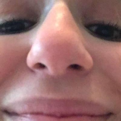 Halli hallo