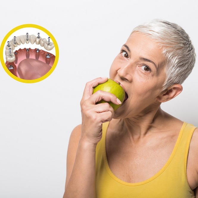 Beyond Aesthetics- How Dental Implants Improve Oral Health