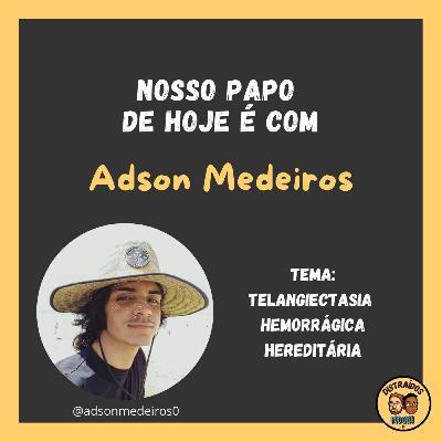 Episódio #019 - Telangiectasia Hemorrágica Hereditária - THH ou Rendu - e seus sintomas (com Adson Medeiros) Episódio #019 - Telangiectasia Hemorrágica Hereditária - THH ou Rendu - e seus sintomas (com Adson Medeiros)