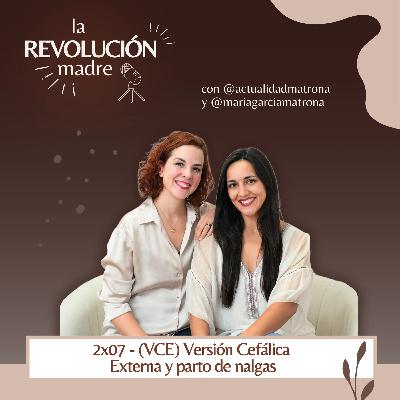 2X07 - (VCE) Versión Cefálica Externa y parto de nalgas