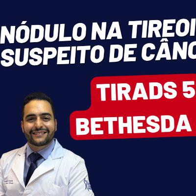 NÓDULO NA TIREOIDE = CÂNCER, COMO SABER? COMO TRATAR? NÓDULO NA TIREOIDE = CÂNCER, COMO SABER? COMO TRATAR?