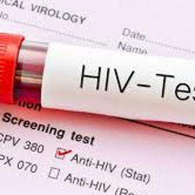 E27. The Specter of AIDS E27. The Specter of AIDS