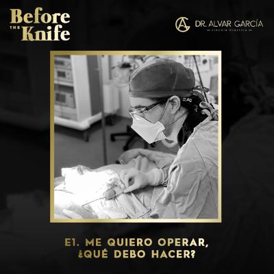 001 - Me quiero operar, ¿qué debo hacer?
