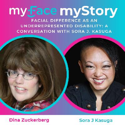 Facial Difference as an Underrepresented Disability: A Conversation with Sora J. Kasuga