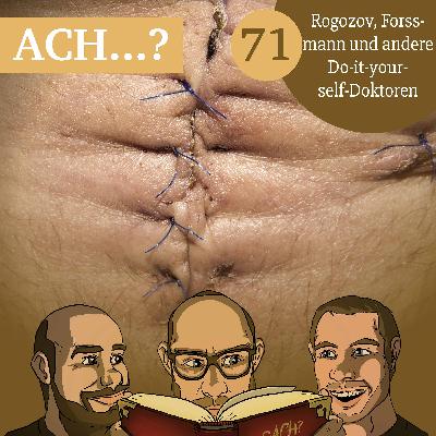 71 – Rogozov, Forssmann und andere Do-it-yourself-Doktoren