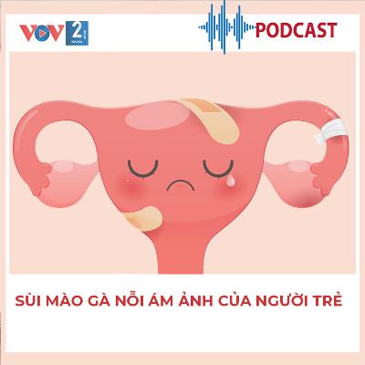 Sùi mào gà nỗi ám ảnh của người trẻ