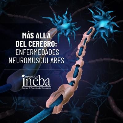 Episodio 2 - Debilidad Muscular Aguda con la Dra. Mariana Bendersky