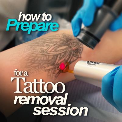 How to prepare for a Tattoo Removal Session