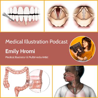 Emily Hromi interview Emily Hromi interview