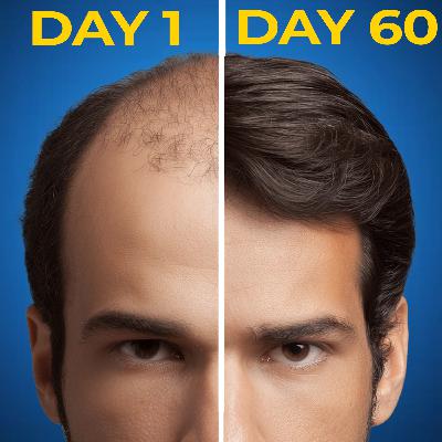 A Complete A to Z for Hair Loss Solutions