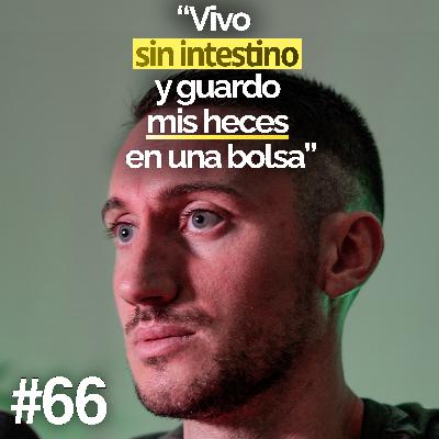 Tener que llevar pañales con 27 años - Ernesto | Un Propósito #67