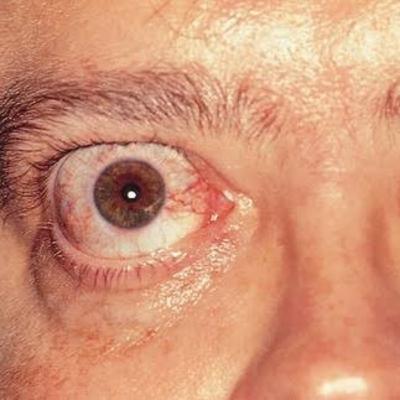 REFLEXÃO SOBRE UM NADA