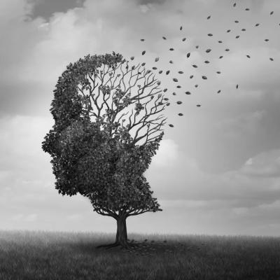 Dementia & Alzheimers disease-#2