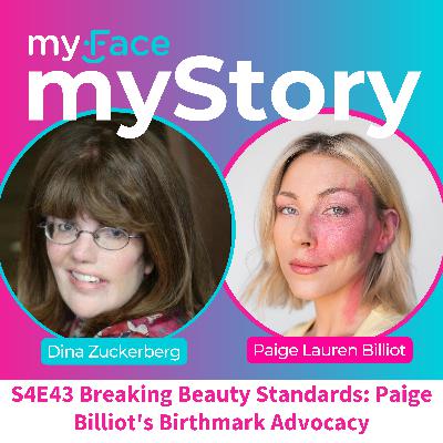 Breaking Beauty Standards: Paige Billiot's Birthmark Advocacy | myFace, myStory
