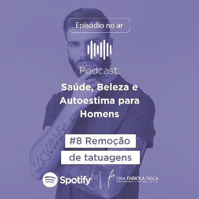Remoção de tatuagens