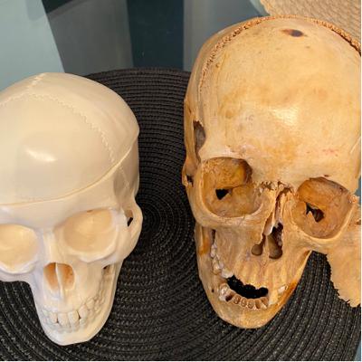 Uma breve história da RadForense