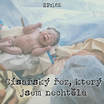 EP162: Císařský řez, který jsem nechtěla