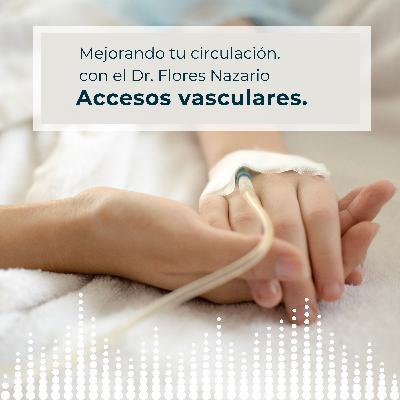 Accesos vasculares. Accesos vasculares.